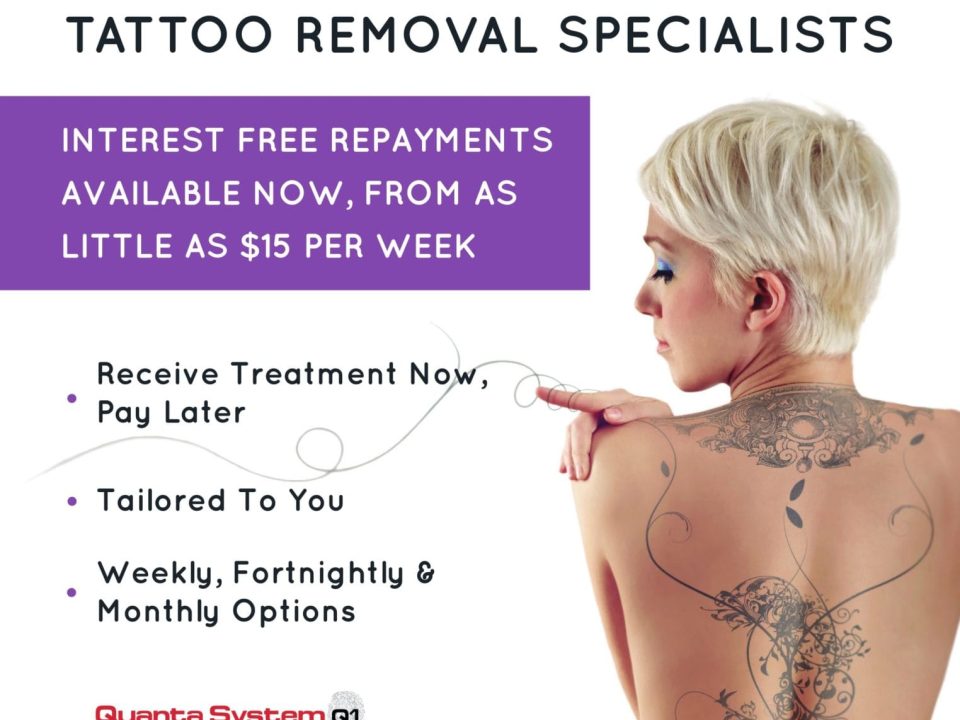 tattoo removal sydney interest free repayments