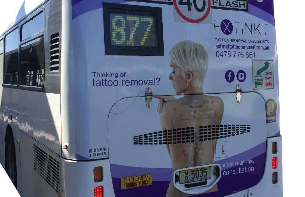 laser tattoo removal sydney bus advertisement