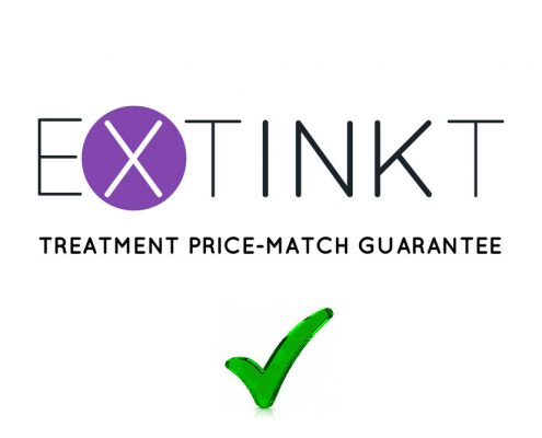 extinkt tattoo removal price match guarantee image