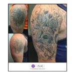 image of new tattoo after laser removal