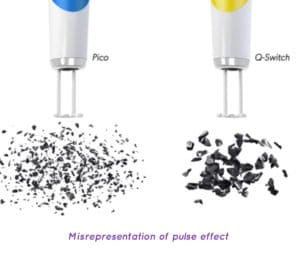 false comparison of tattoo removal laser pulses